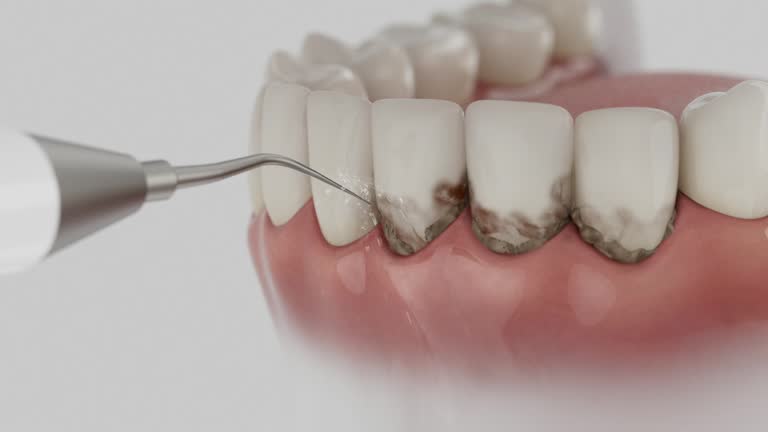 Trusted Dental Crowns And Bridges service in Dundee, NY - Dentist Open Now